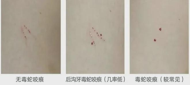 深圳近期接诊9例！网友吓坏公园再次惊现！紧急提醒：(图2)